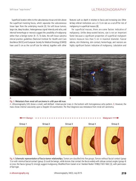 ultrasound test of soft parts|ultrasound for soft tissue aspiration.